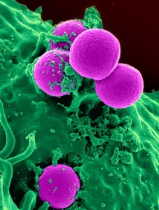 white-blood-cell-543471_640