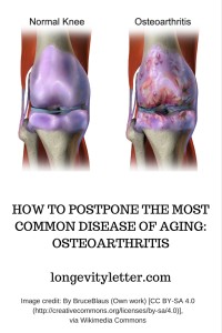 How to postpone the most common disease of aging_ osteoarthritis