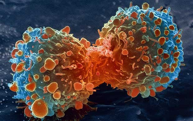 Source: http://i.telegraph.co.uk/multimedia/archive/02469/cancer-lambert_2469736b.jpg